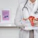 Polikistik Over Sendromu (PCOS) Nedir